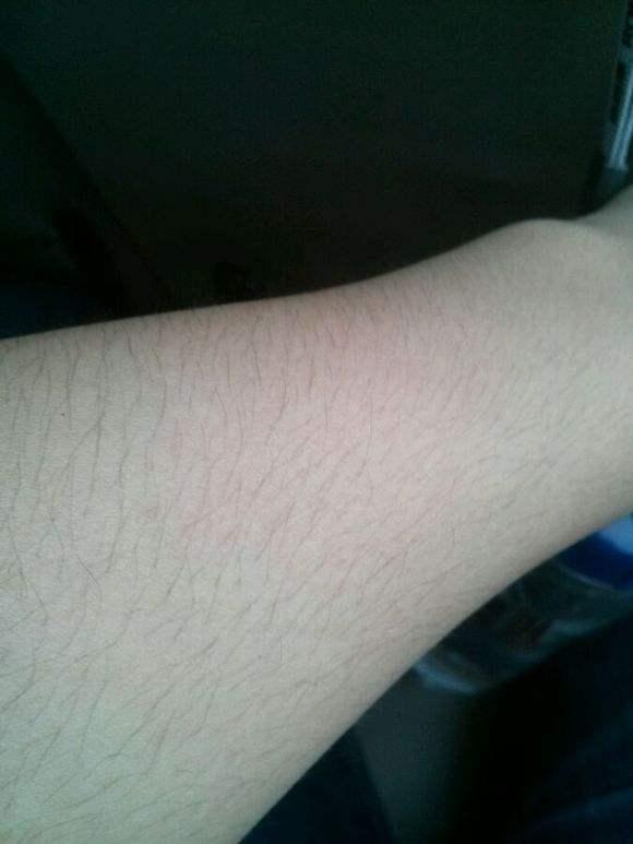 烟酰胺会长毛是真的吗,烟酰胺真的会让皮肤长毛吗