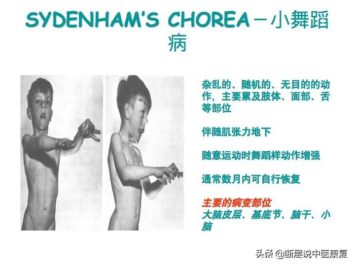 中枢神经系统断层解剖讲解,中枢神经3d解剖动画