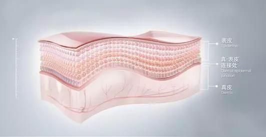 剖腹产的疤痕增生怎么除疤,疤痕体质如何才能正确除疤