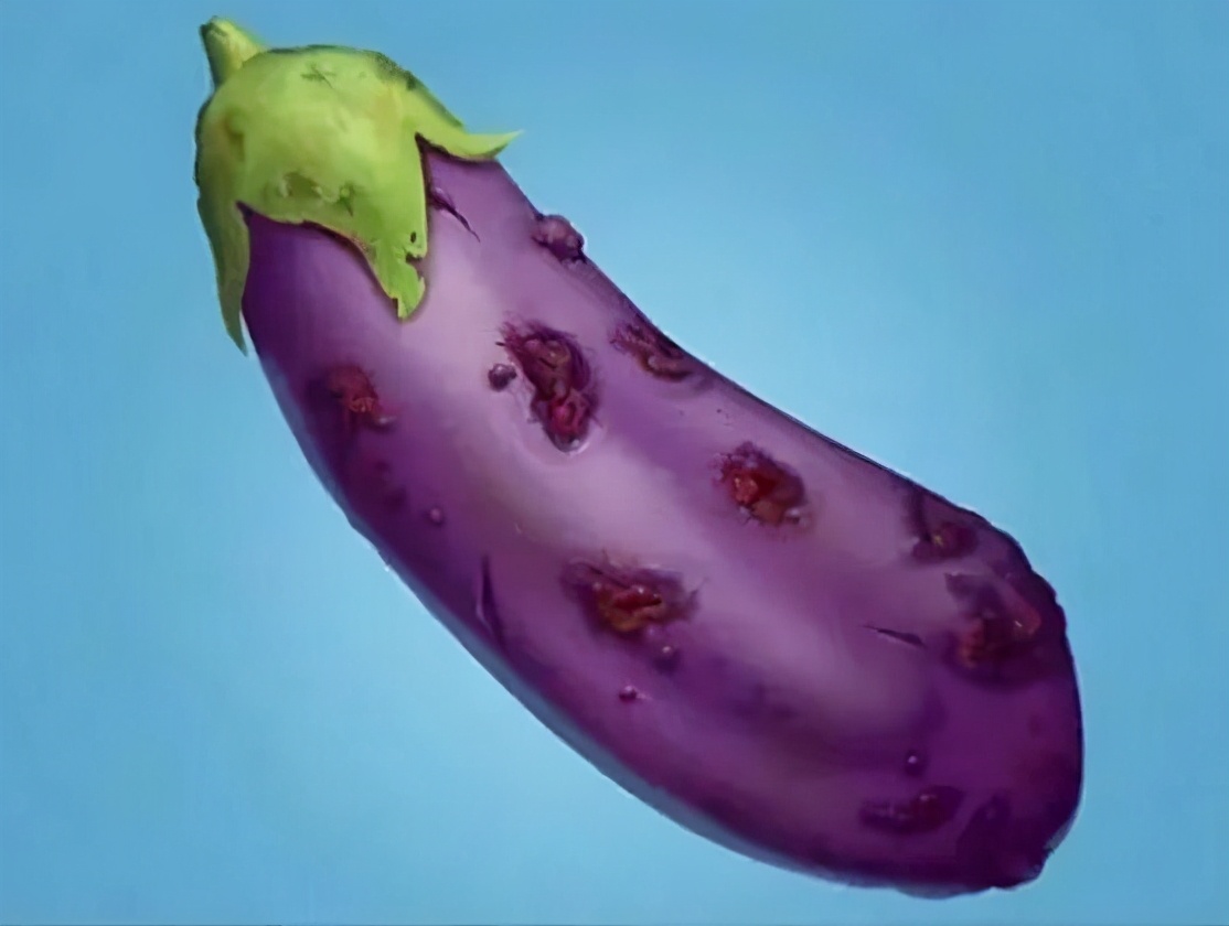 丁丁上怎么长了“小疙瘩、小红点”?难道是染上了性病?