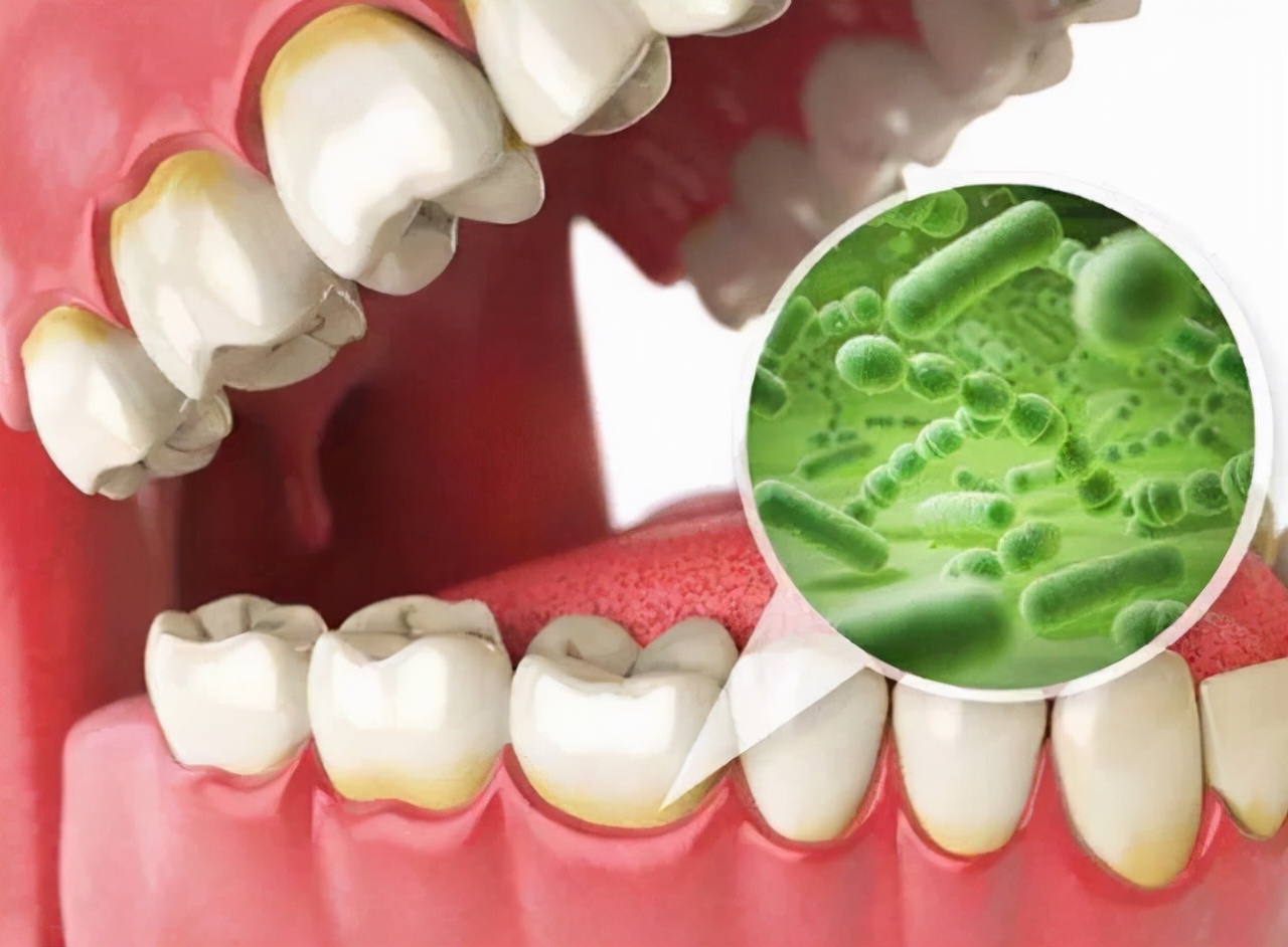 成人肠胃不好口臭除根的最好办法,成人口臭是怎么回事怎么治疗