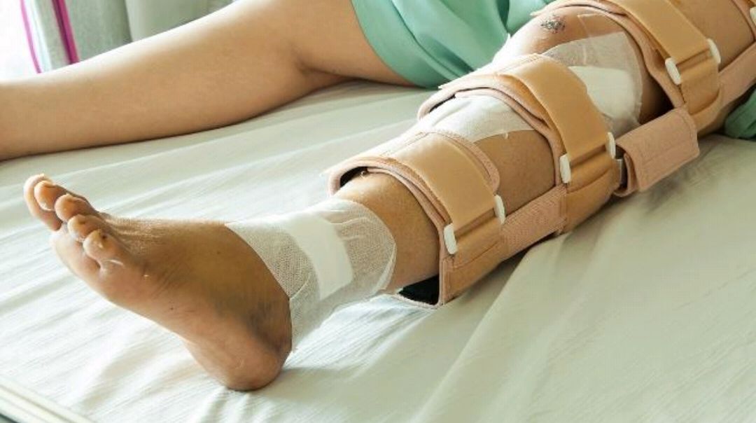 骨折后，人体会经历怎样的变化？