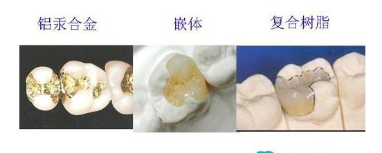 我的牙齿都掉了,牙齿烂掉一半可以直接补牙吗