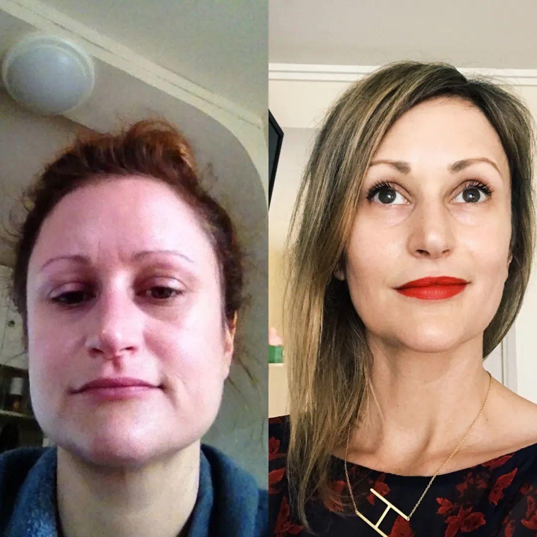 昨天脸瘦今天脸胖,昨天脸是白的今天早上起来就黑了