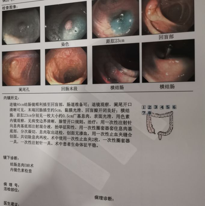 肚子痛大便次数多是什么原因,肚子痛大便次数多吃药就好