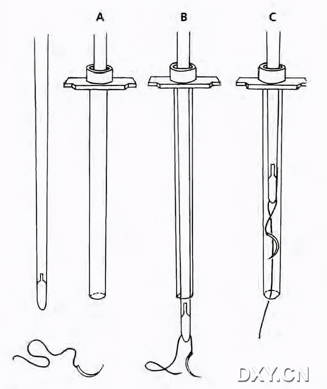 腹腔镜下切割缝合器使用视频,腹腔镜下缝合教程