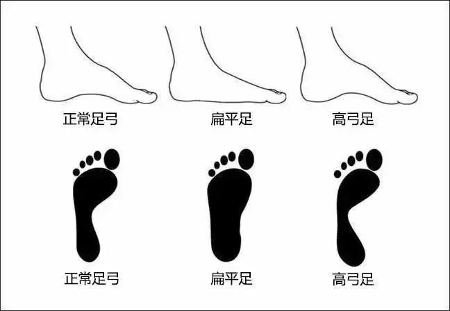 怎么选择合适的羽毛球鞋,怎么判断自己适合什么羽毛球球鞋