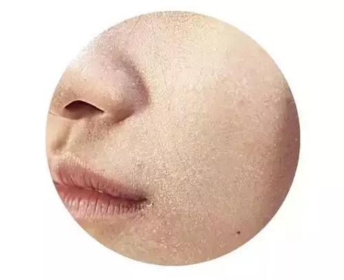 十大公认好用的水乳秋冬,秋冬怎样选水乳