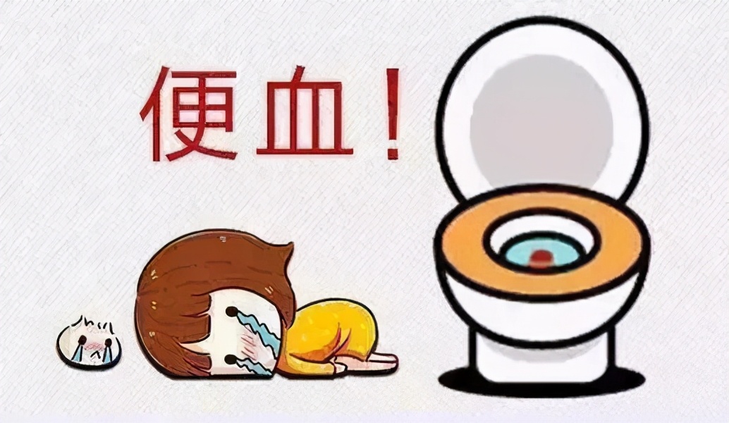大便出血有轻重！若是出现这4种情况，一定得去看医生