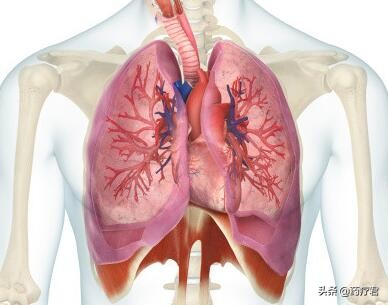 拍胸片查出纹理增多是什么意思呢,拍胸片查出肺结节是肺癌吗