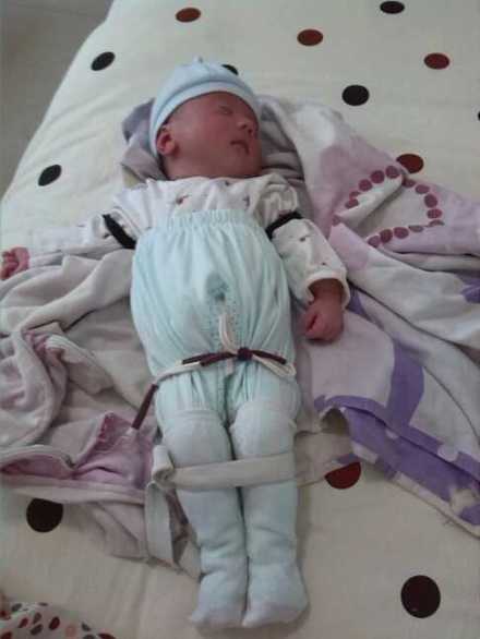 月子里宝宝不捆腿会罗圈腿吗,怕宝宝腿弯怎么去处理