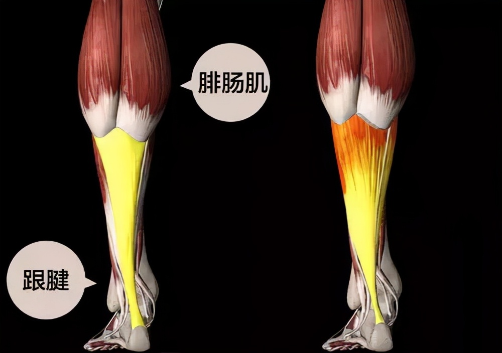 运动不当伤脚筋怎么治,健康之路运动不当脚遭殃