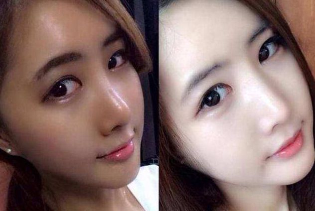 烟酰胺会烂脸吗,为什么抹了烟酰胺越来越黑