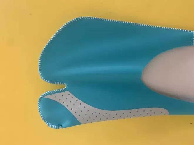 大脚趾拇指外翻矫正用多久,大脚拇指外翻导致第二脚趾弯曲