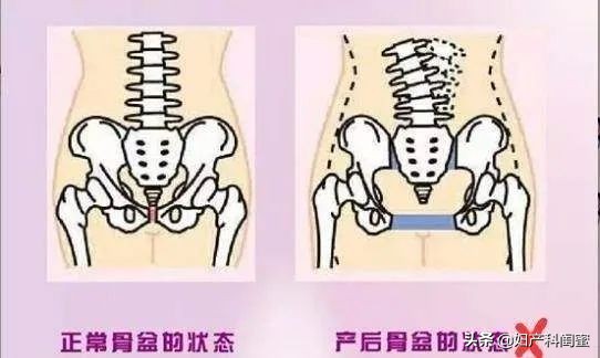 产后能恢复到少女时期的紧致,产后恢复的7条建议