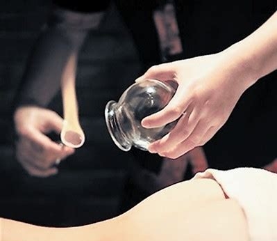 拔罐需要注意什么事项,肚子拔罐方法及注意事项