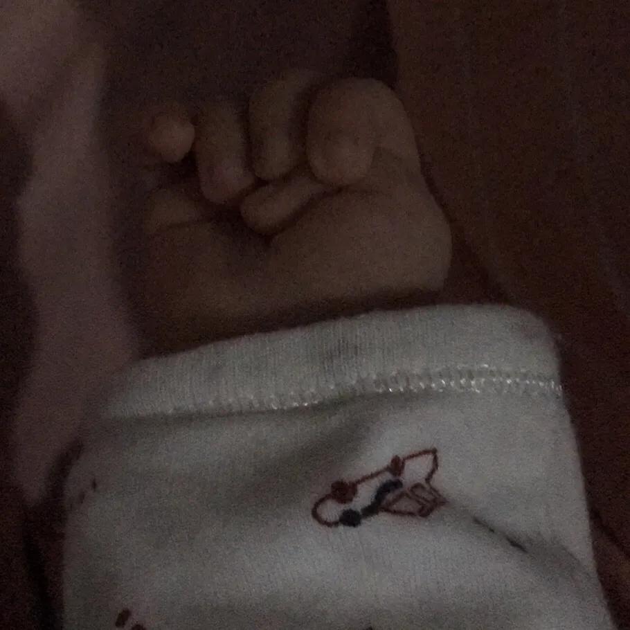 宝宝的手大拇指内弯,宝宝的拇指都是向着掌心的吗