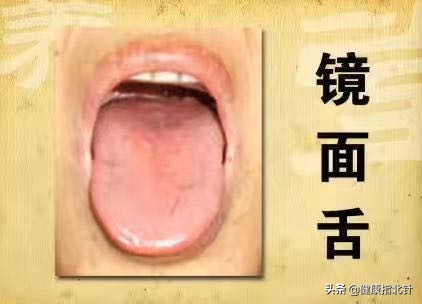 一招教你看舌苔6种舌苔你是哪种,身体好不好看嘴唇就知道了