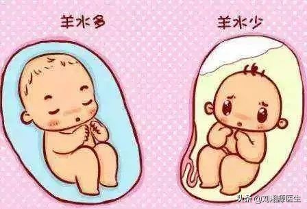 孕妇自身免疫疾病导致羊水少怎办,妊娠合并羊水过多