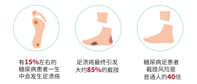 糖尿病足的痛苦,糖尿病足疼痛的不行怎么办