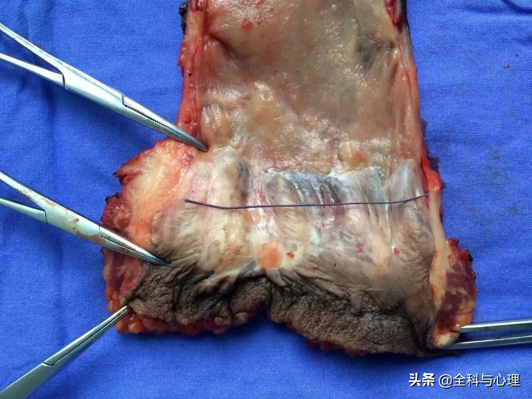 肛门有肿块，可能是这8种疾病！这些知识你要知道