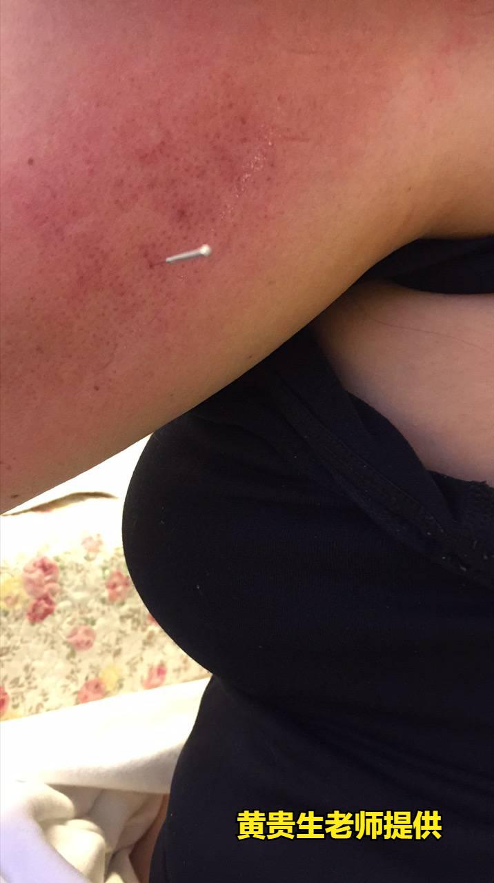 和癌症一起做斗争,癌症防治大赛