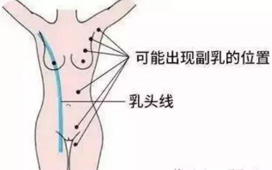 产后副乳最好的解决方法,产后副乳怎么才能消除