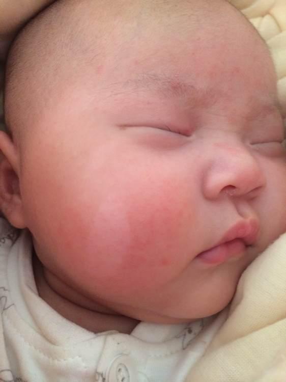 小孩身上有一块白斑怎么回事,身上有一块白斑汗毛也是白的