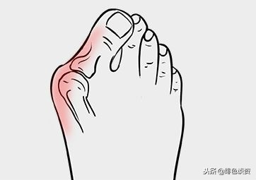 怎样穿高跟鞋更优美,穿高跟鞋怎么走路既好看又舒适