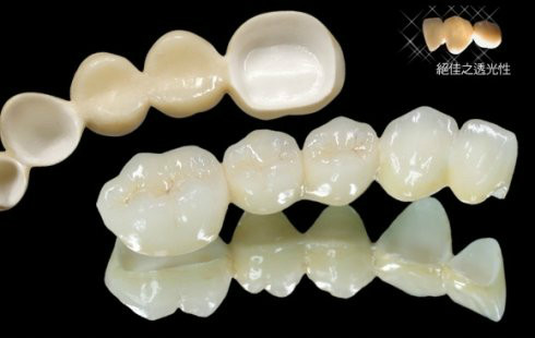 现在最便宜的假牙多少钱一颗,目前国内最好的假牙是多少钱