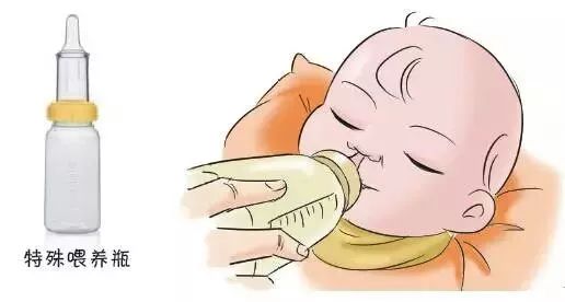 新生儿科普知识小视频,为什么我的宝宝会有唇腭裂