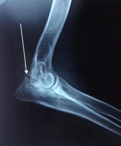 犬分离性软骨病,犬的主要疾病有哪些