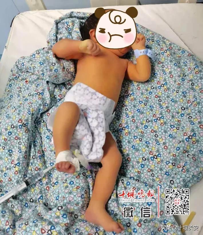 刚出生就换血怎么回事,出生10天全身换血严重吗