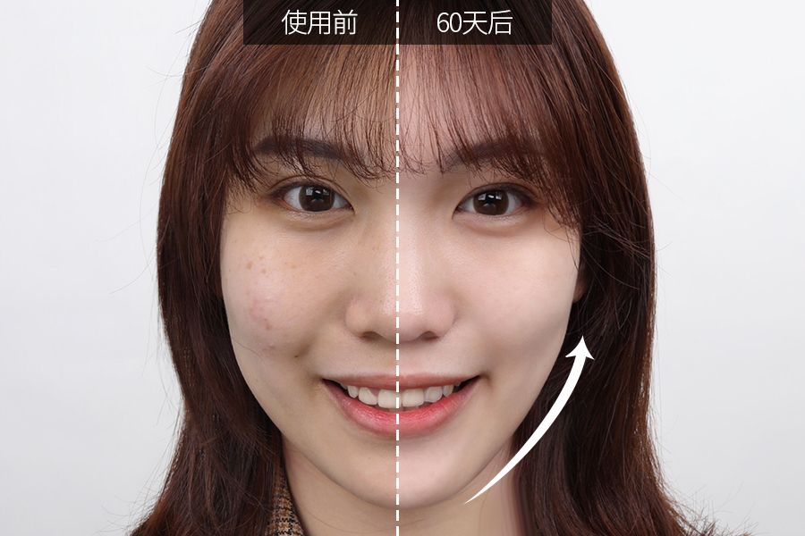 琚佸濮楁帹鑽愯憽钀勭苯鎶よ偆,琚佸濮楄憽钀勭苯绮惧崕