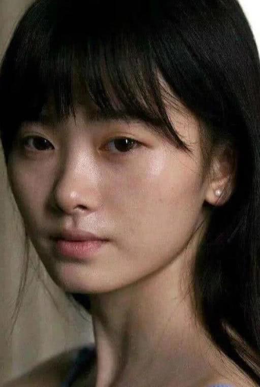 贵族手术的好处,鼻基底手术失败凹陷怎么改善