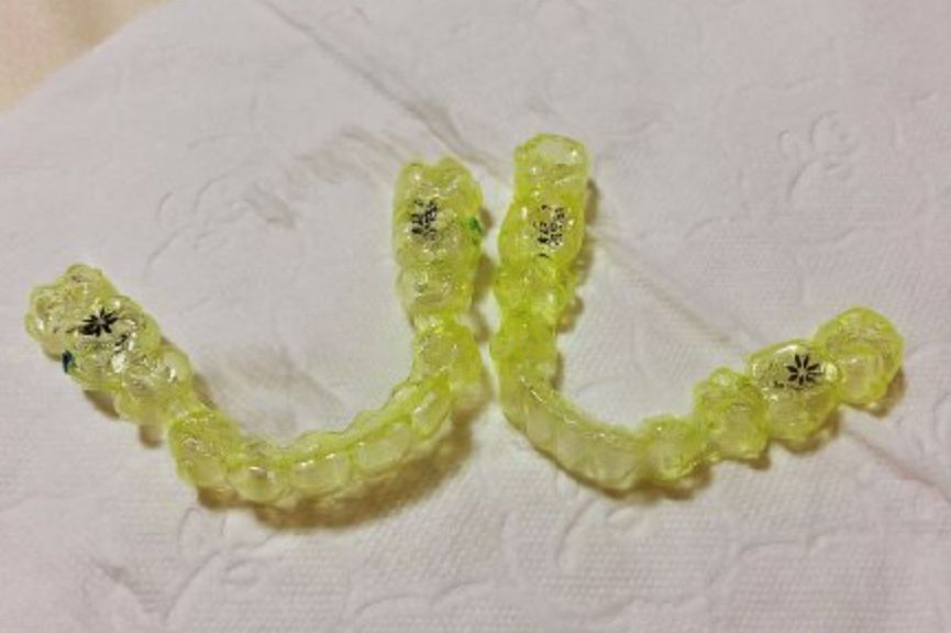 错过青春又如何,错过生长发育期怎么办