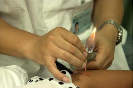 针灸治疗的效果令国外惊叹视频,贺氏针灸三通法怎么样