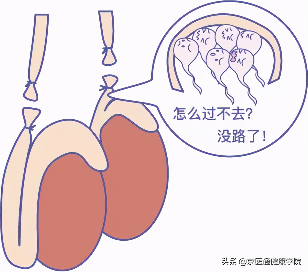 古代避孕最有效的方法,中医紧急避孕补救法大全