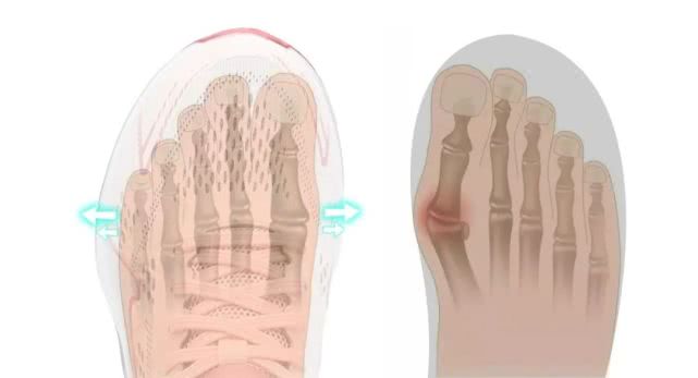 合脚的鞋只有脚知道,合脚的鞋子好吗