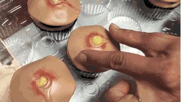 挤黑头和吸黑头哪个对毛孔损伤大,改掉挤黑头的习惯黑头会有改善吗