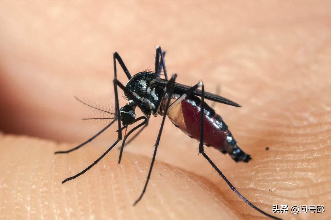 为什么有的人被蚊子叮了不痒,为什么有的人不招蚊子叮咬