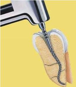 牙医使用的钻头型号,牙医的钻头都是什么作用