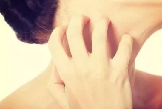 头皮白癜风症状好转图片,白癜风好转的几个迹象图片