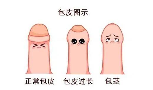 带孩子割包皮家长要准备什么,割包皮只有在暑假的时候才能割吗