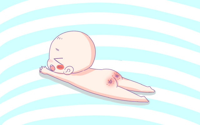 护臀膏怎么选择,护臀膏怎么选