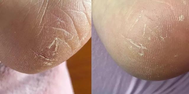 手模怎么护手的,手膜怎么护手视频教程