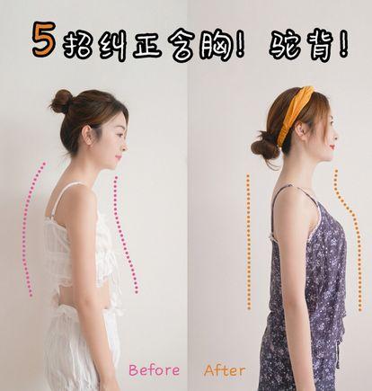 瘦背改善含胸驼背缩小斜方肌,含胸驼背矫正懒人