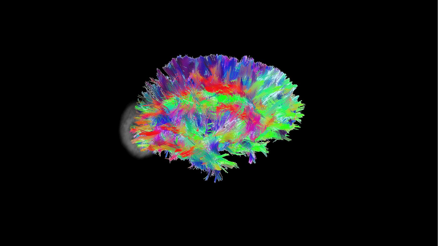 吃阿司匹林可以预防脑出血吗,阿司匹林可以预防脑出血吗