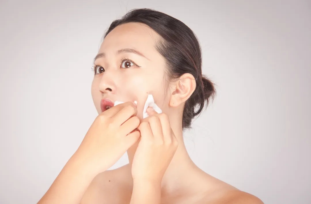 不同痘坑凹洞擦什么药膏,不同痘坑怎么修复