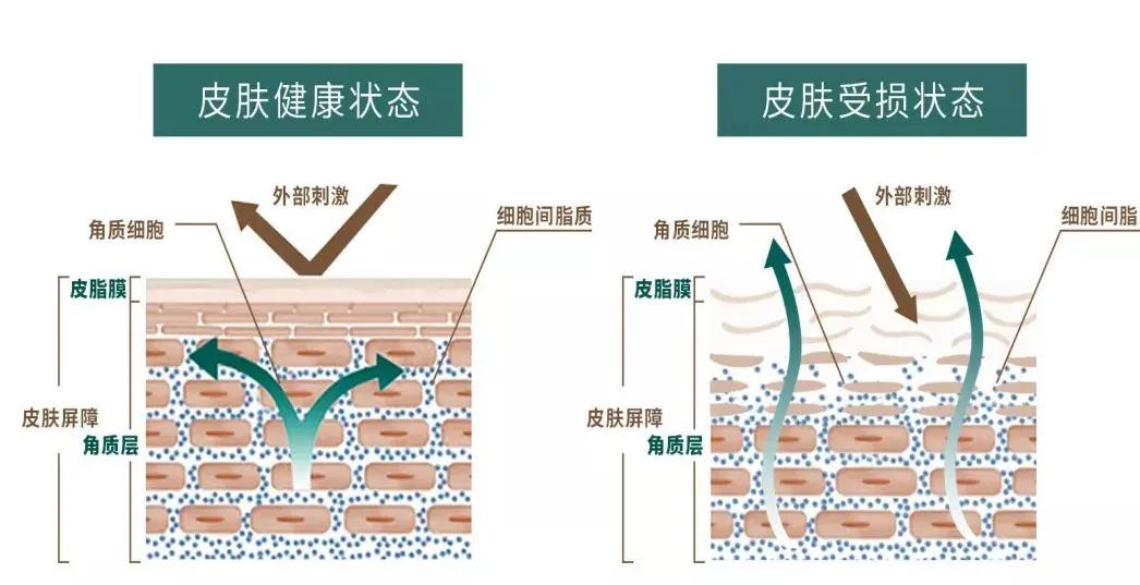 烂脸怎么办女生,女生烂脸自救的方法